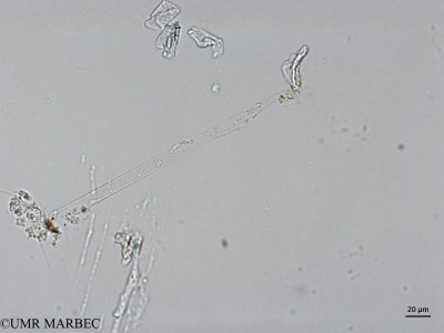 phyto/Brazilian_Nordeste/AtoldasRocas_station52/ABRACOS2 April 2017/Rhizosolenia styliformis (Snap-6329)(copy)_thumb.jpg